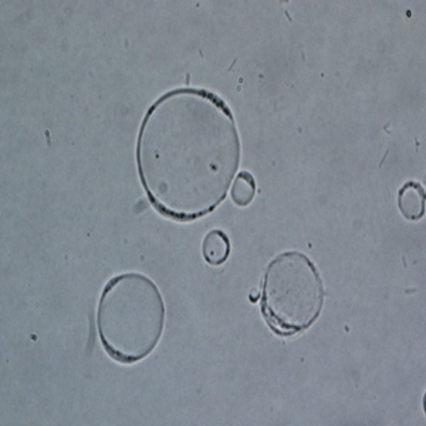 Forma vacuolar de Blastocystis sp. observado al microscopio con un aumento de 400 veces.