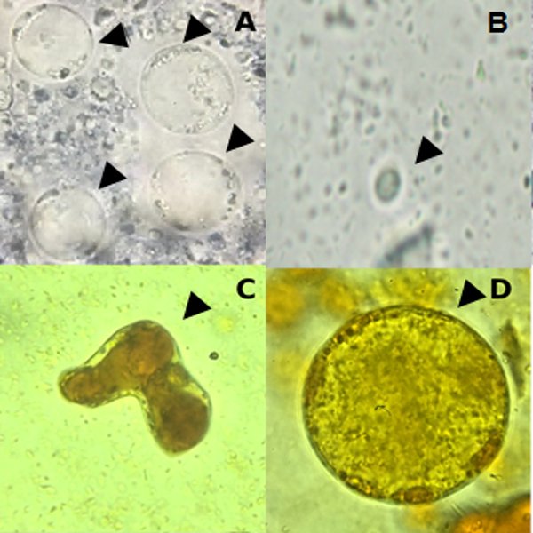 Diferentes formas de Blastocystis sp. observadas al microscopio con un aumento de 400 veces y señaladas por flechas. En A, forma vacuolar; en B, forma de quiste; en C, forma ameboidea y en D, forma granular.